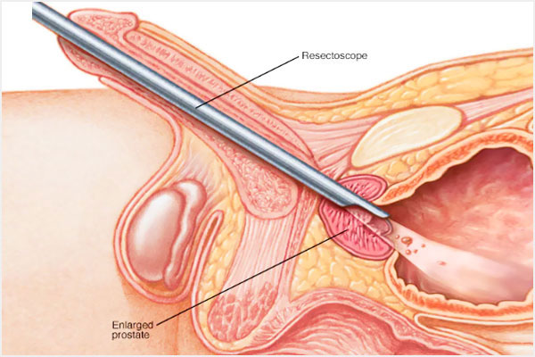 Aadira Kidney Care