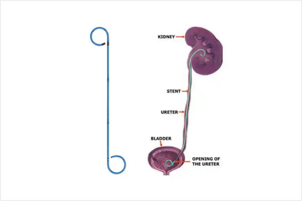 Aadira Kidney Care