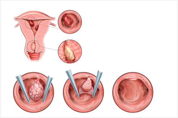 Aadira Kidney Care