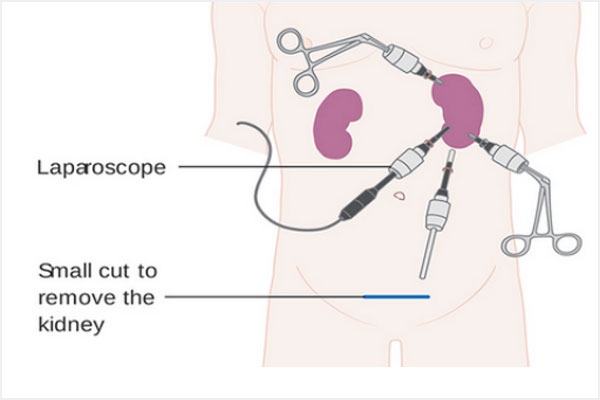 Aadira Kidney Care