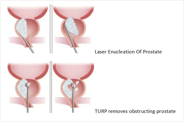 Aadira Kidney Care