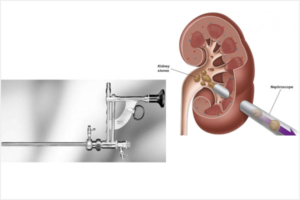 Aadira Kidney Care