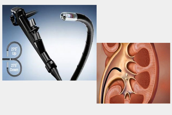 Aadira Kidney Care